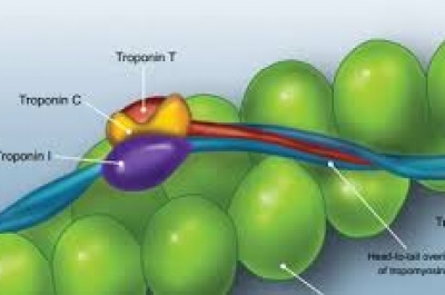 sử dụng xét nghiệm troponin i độ nhạy cao trong chẩn đoán nhồi máu cơ tim cấp - thông tin đồng thuận từ ban cố vấn